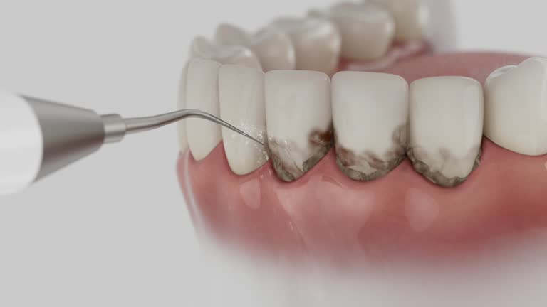Trusted Teeth Cleaning And Checkup service in Porter, IN - Dentist Open Now